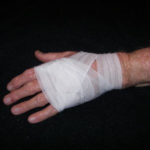 How to Figure OSHA DART Rates